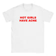 HOT GIRLS HAVE ACNE - BABY TEE – White