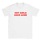 HOT GIRLS HAVE ACNE - BABY TEE – White